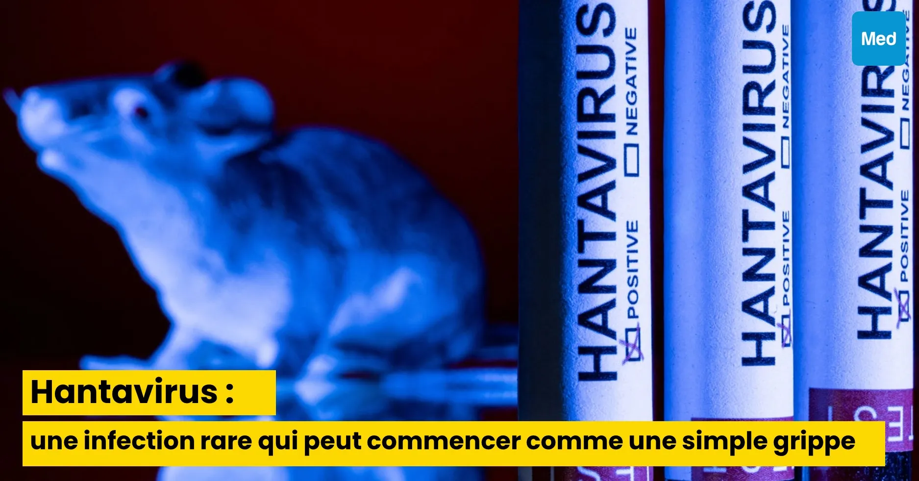 Hantavirus : une infection rare qui peut commencer comme une simple grippe
